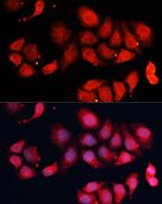 CDK7 Antibody in Immunocytochemistry (ICC/IF)