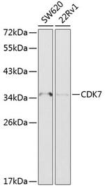 CDK7 Antibody in Western Blot (WB)