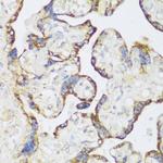 ECH1 Polyclonal Antibody