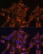 HSD17B8 Polyclonal Antibody