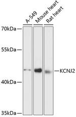 Kir2.1 (KCNJ2) Polyclonal Antibody