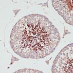PGK2 Antibody in Immunohistochemistry (Paraffin) (IHC (P))