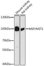 MSP Antibody in Western Blot (WB)