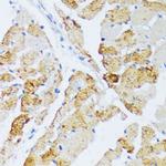 WSB2 Polyclonal Antibody