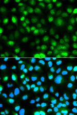 Ataxin 3 Polyclonal Antibody