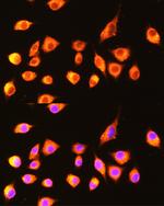 GBP2 Polyclonal Antibody