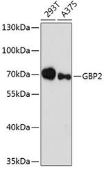 GBP2 Antibody in Western Blot (WB)