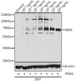 GBP2 Antibody in Western Blot (WB)