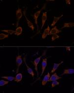RPL32 Antibody in Immunocytochemistry (ICC/IF)