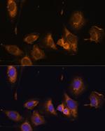 RPL32 Polyclonal Antibody