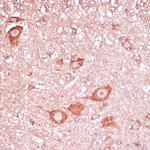 RPL32 Antibody in Immunohistochemistry (Paraffin) (IHC (P))