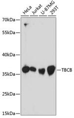 CKAP1 Antibody in Western Blot (WB)