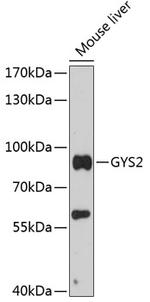 GYS2 Polyclonal Antibody