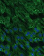HAL Polyclonal Antibody