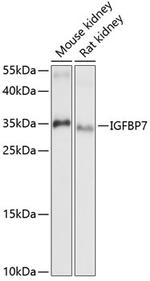 IGFBP7 Polyclonal Antibody