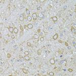 MTNR1A Polyclonal Antibody