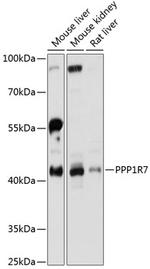 PPP1R7 Antibody in Western Blot (WB)