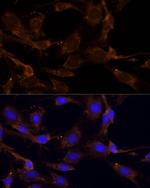 RPL27 Antibody in Immunocytochemistry (ICC/IF)