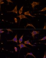 RPL27 Antibody in Immunocytochemistry (ICC/IF)