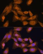 RPL27 Antibody in Immunocytochemistry (ICC/IF)