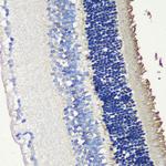 S-arrestin Polyclonal Antibody