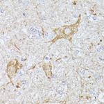 TBCA Polyclonal Antibody