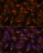 IFITM3 Polyclonal Antibody