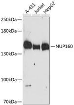 NUP160 Polyclonal Antibody