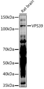 VPS39 Polyclonal Antibody