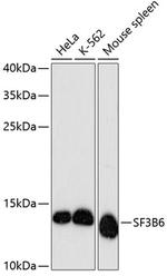 SF3B14 Polyclonal Antibody