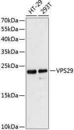 VPS29 Polyclonal Antibody