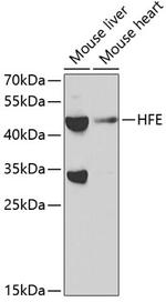 HFE Polyclonal Antibody