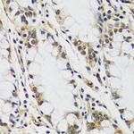 Casc5 Polyclonal Antibody