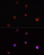 NLRC4 Antibody in Immunocytochemistry (ICC/IF)