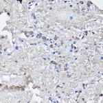 NLRC4 Antibody in Immunohistochemistry (Paraffin) (IHC (P))