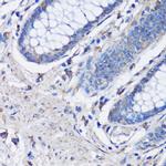 NLRC4 Antibody in Immunohistochemistry (Paraffin) (IHC (P))