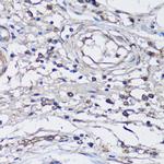 NLRC4 Antibody in Immunohistochemistry (Paraffin) (IHC (P))