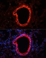 NLRC4 Antibody in Immunohistochemistry (IHC)