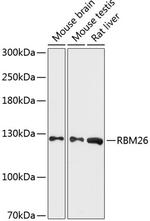 RBM26 Polyclonal Antibody
