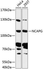 NCAPG Polyclonal Antibody