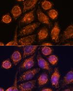 Mtmr9 Antibody in Immunocytochemistry (ICC/IF)