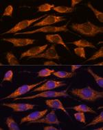 Mtmr9 Antibody in Immunocytochemistry (ICC/IF)