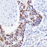 Mtmr9 Antibody in Immunohistochemistry (Paraffin) (IHC (P))