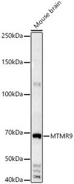 Mtmr9 Antibody in Western Blot (WB)