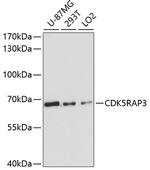 CDK5RAP3 Polyclonal Antibody