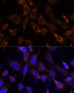 VPS25 Polyclonal Antibody