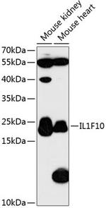 IL1F10 Polyclonal Antibody