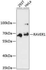 RAVER1 Polyclonal Antibody