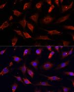 DNASE1L1 Antibody in Immunocytochemistry (ICC/IF)