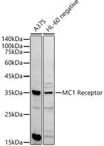 MC1R Polyclonal Antibody